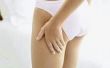 How to Get Rid van cellulitis op de bovenbenen