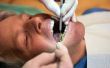 De gemiddelde kosten van tandheelkundige verzekering