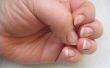 How to Take Care van het nagelbed van een Split