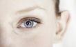 De beste behandelingen te verminderen ogen wallen