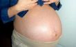 Tekenen van zwangerschap: constipatie