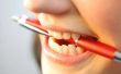 Het verwijderen van vlekken van tandheelkundige Bonding