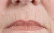 Hoe te voorkomen dat de lijnen van de Lip