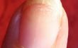 Hoe te repareren van Split Nails