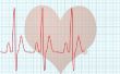 Hoe om te lezen van fundamentele EKG