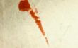 Hoe te verwijderen van de gedroogde bloed vlekken uit kleding en andere stoffen