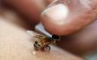 Hoe de behandeling van een bijensteek