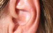 Hoe te ontbinden van een oor Wax Plug