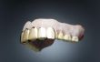 Het lijmen van gebroken tandheelkundige kunststof