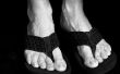 Behandelingen voor gebarsten hielen & voet eelt