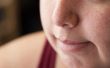 How to Get Rid van een vettige neus