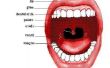 Angina pectoris keel symptomen