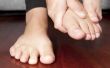 Hoe te behandelen neuropathie in voeten