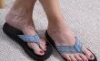 Hoe kom je van donkere vlekken van voeten