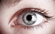 Welke oorzaken Cholesterol deposito's rond de ogen?