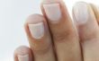 Hoe om te voorkomen dat nagellak scheiden