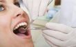 VA tandheelkundige voordelen