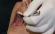 Financiële bijstand voor tandheelkundige ingrepen