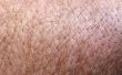 Hoe te scheren van de huid mol