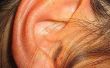 Behandelingen voor aangesloten op de oren