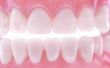 Hoe te verzachten van Plaque op tanden