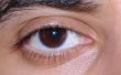 How to Get Rid van een bloeddoorlopen ogen veroorzaakt van een Hit