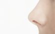 Wissen van een donkere vlek op de neus van Peeling huid