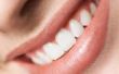 Tanden Whiteners & Whitening tandpasta voor koffie Drinkers