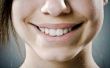 Hoe te verwijderen van de witte vlekken op de tanden