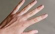 Een huis remedie voor gebarsten nagelriemen & droge handen