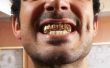 Hoe te herstellen van Dental goud