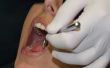 Het verschil tussen een tandheelkundig Plan & tandheelkundige verzekering