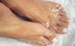 How to Cure voeten schimmel