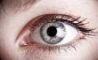 Tekenen & symptomen van een koortslip in je ogen