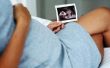 Manieren om u te vertellen zijn zwanger zonder een zwangerschapstest