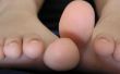 Hoe te voorkomen dat de infectie in een besnoeiing van de voet