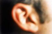 Tekenen & symptomen van Psoriasis van het oor