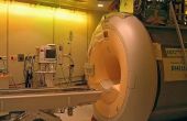 Over MRI-Scans