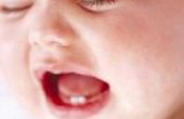 Kunnen een Baby tandjes symptomen komen & gaan?