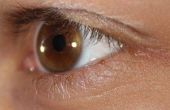 Wat zijn Prednisolon oogdruppels gebruikt voor?
