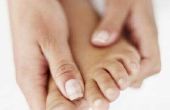 How to Cure jeukende handen & voeten 's nachts