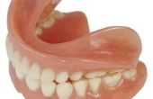 Manieren om reparatie teruggetrokken tandvlees tussen de tanden