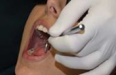 Hoe om te bepalen of een tand lekt een infectie