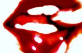 Welke medische voorwaarde heeft heldere rode lippen als een symptoom?