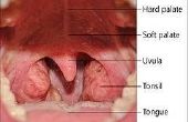 Symptomen van keel Herpes
