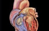Symptomen van hart ventiel schade