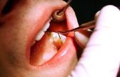 Hoe vindt u vrije tandheelkundige zorg voor volwassenen in Tennessee