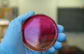 Hoe te detecteren besmetting in Agar platen