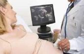 Baby echografie technicus salaris