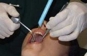 Hoe om te leren van tandheelkundige handinstrument reparatie